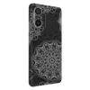 Mi 11X Flat Back Skins & Wraps